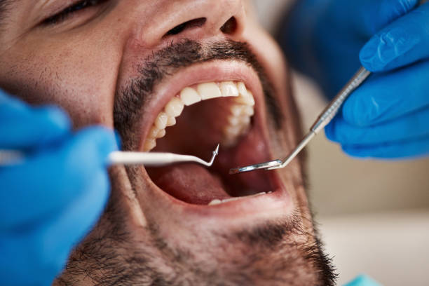 Best Cosmetic Emergency Dentistry in Mcconnell Af, KS