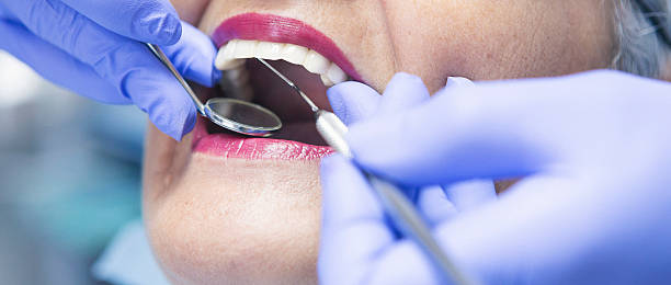 Best Emergency Dental Care for Broken or Chipped Teeth in Mcconnell Af, KS
